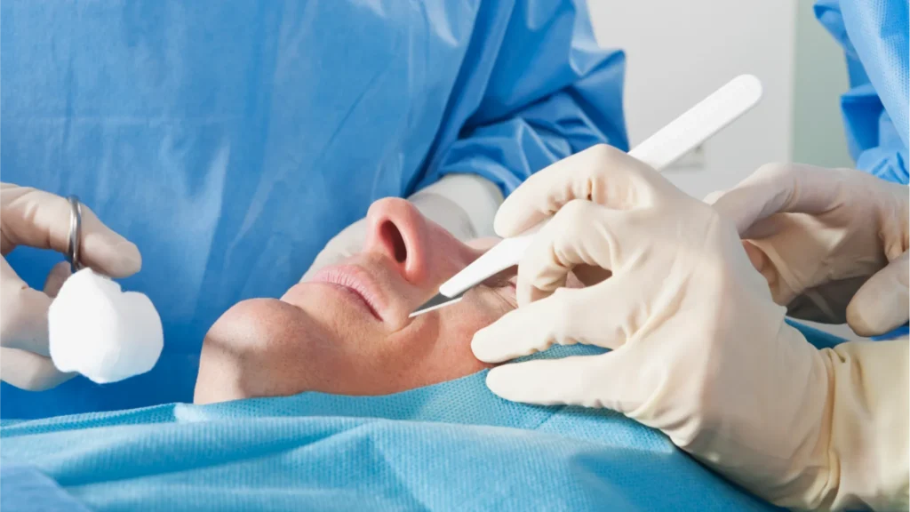 تجميل الأنف في اسطنبول