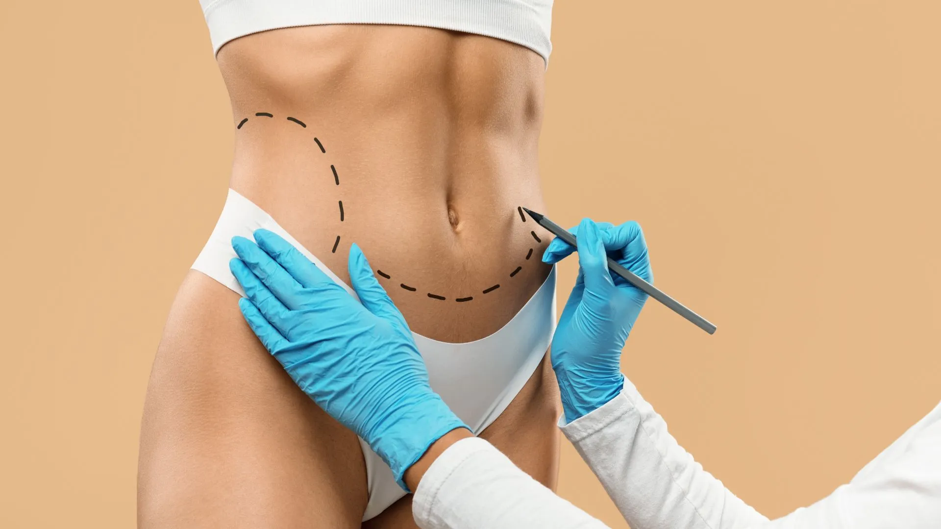 عملية نحت البطن في اسطنبول