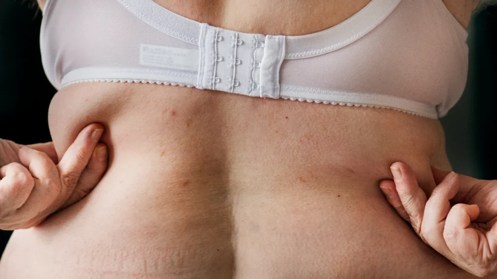 نقل الدهون في اسطنبول تركيا