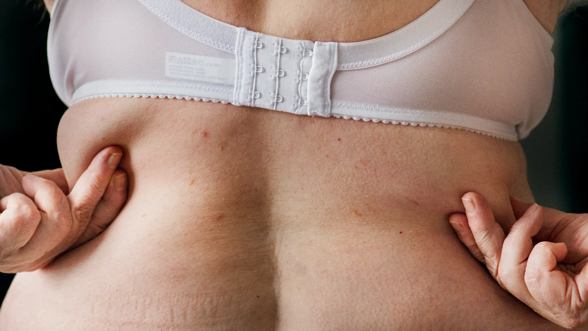 نقل الدهون في اسطنبول تركيا