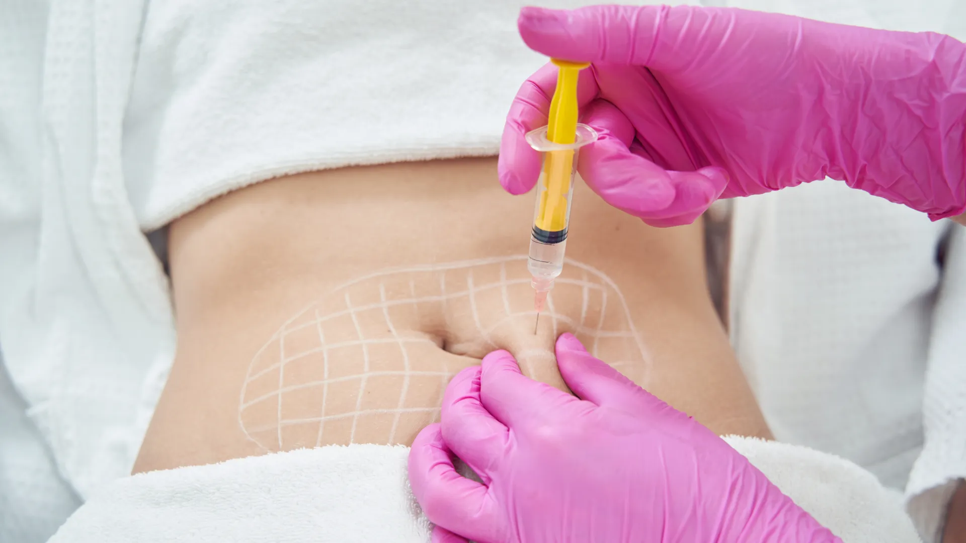 نقل الدهون في اسطنبول تركيا